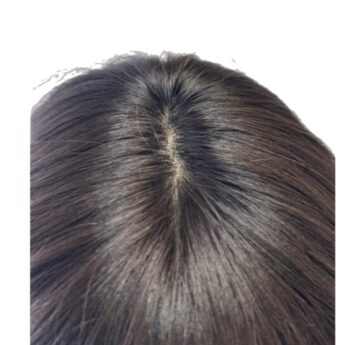 Mirena - Image 3